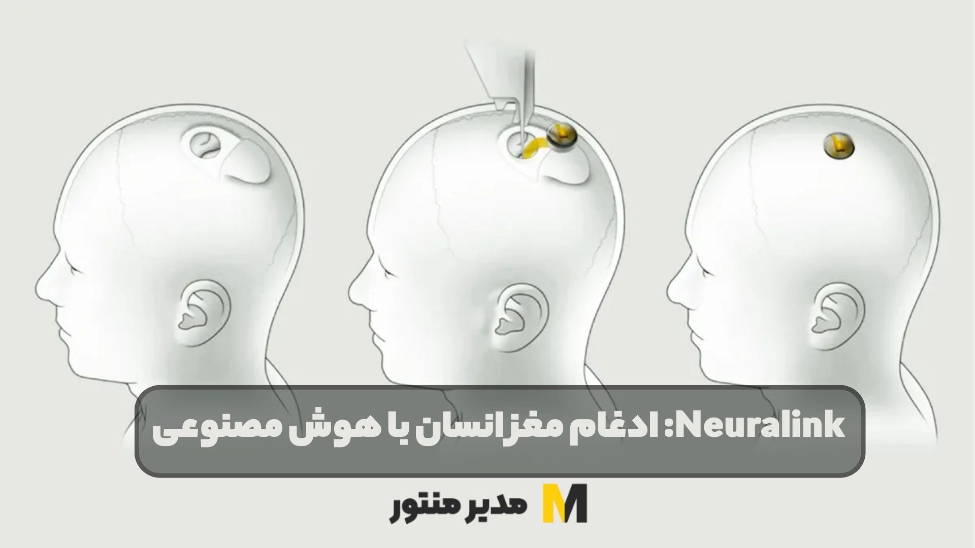 Neuralink: ادغام مغز انسان با هوش مصنوعی