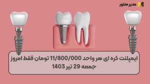 ایمپلنت کره ای هر واحد 11/800/000 تومان فقط امروز جمعه 29 تیر 1403