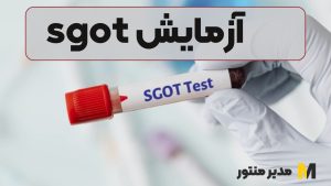 آزمایش sgot