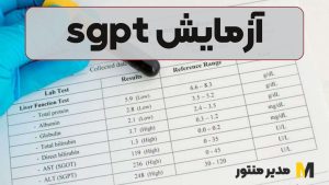 آزمایش sgpt