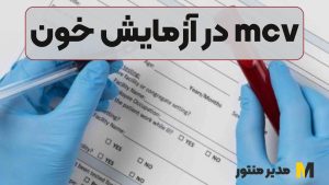 mcv در آزمایش خون