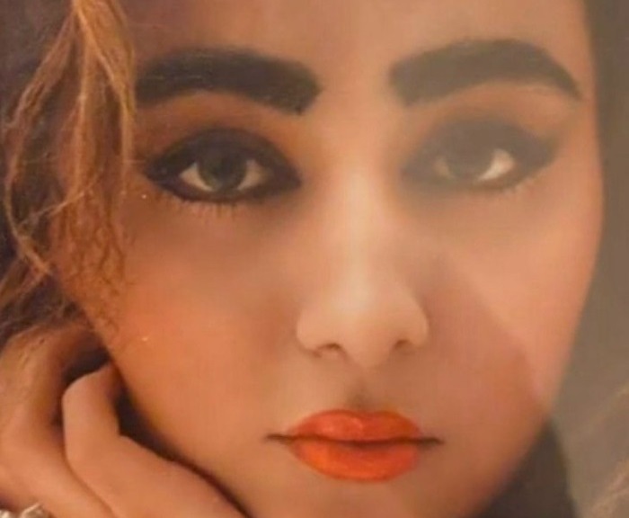 بهنوش بختیاری قبل از عمل